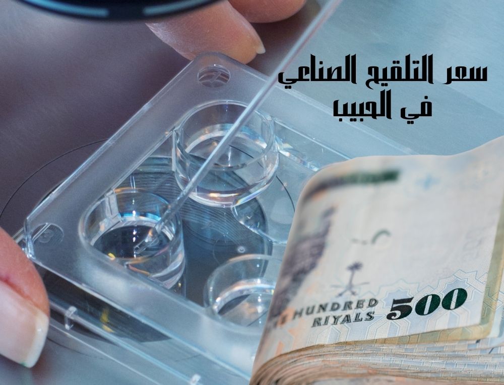 سعر التلقيح الصناعي في الحبيب